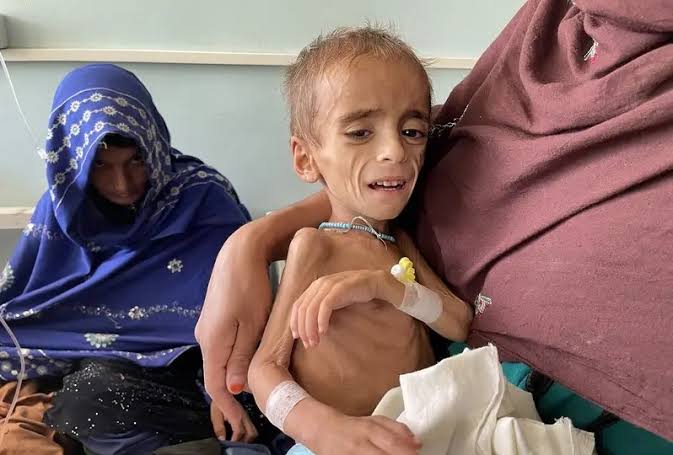 بر اساس گزارش IPC، حدود ۱۵.۹ میلیون نفر، یعنی ۳۲ درصد از جمعیت تحلیل‌شده، اکنون در سطوح بحرانی یا وخیم‌تر گرسنگی (مرحله ۳ یا بالاتر IPC) قرار دارند.